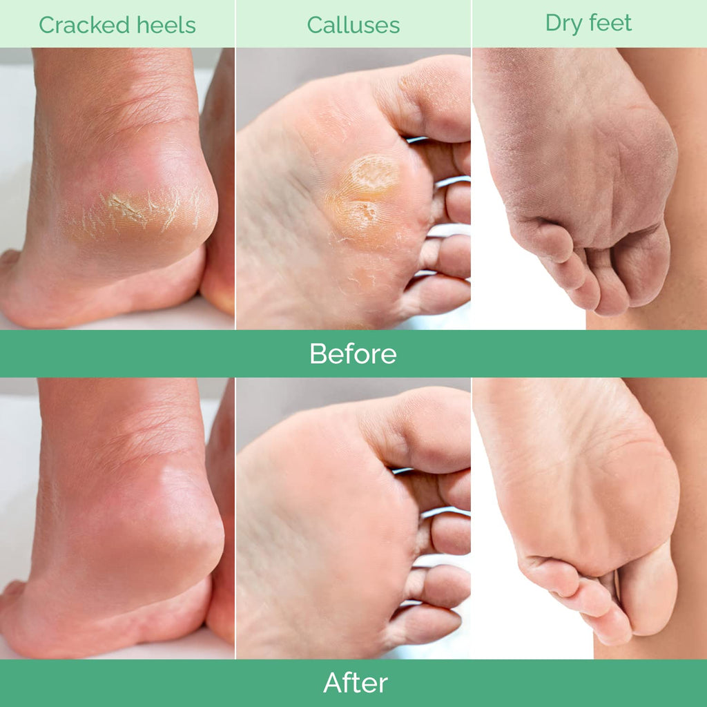 The Peach Foot Peel Mask (2 Pack)